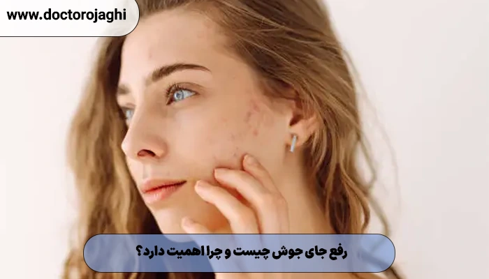 رفع جای جوش چیست؟