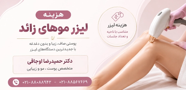 عوامل موثر برروی هزینه لیزر موهای زائد