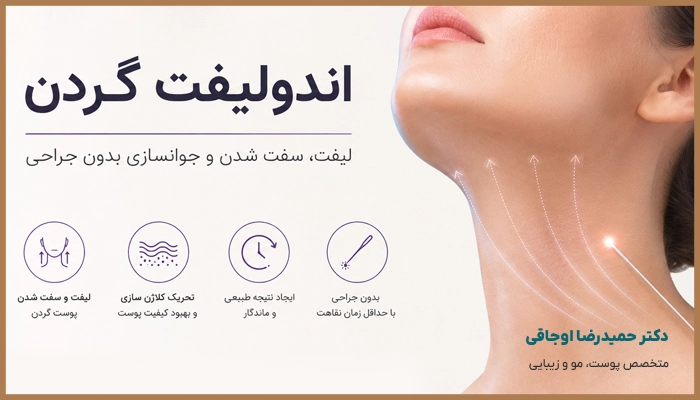 اندولیفت گردن برای چه افرادی مناسب است؟