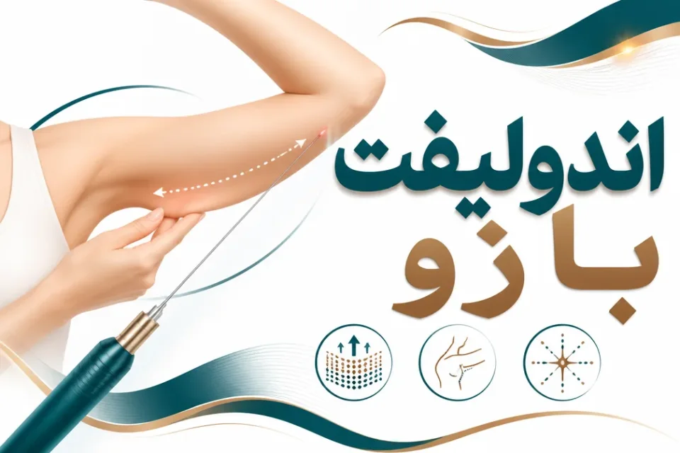 اندولیفت بازو