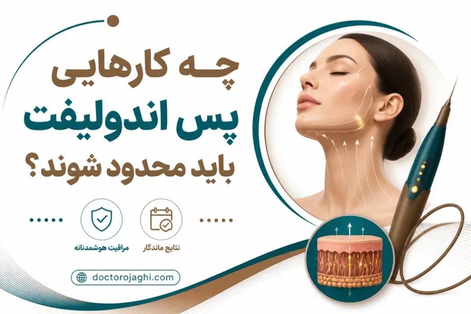 روشهای به حداقل رساندن عوارض اندولیفت