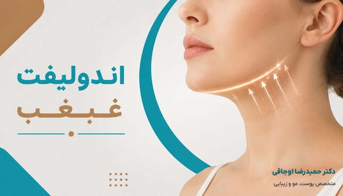 تاثیرات مثبت اندلیفت غبغب