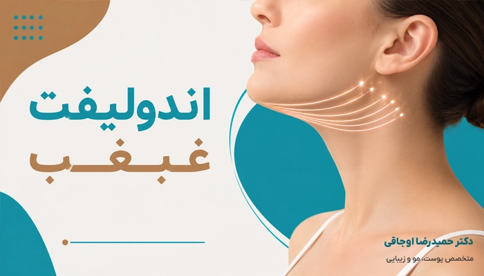 ماندگاری نتایج اندلیفت غبغب چقدر است؟