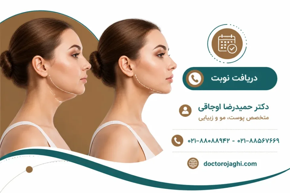 بهترین سن برای اندولیفت در نواحی مختلف صورت — سن مناسب اندولیفت